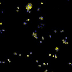 Invitrogen Goat anti-Human IgG (H+L) Cross-Adsorbed Secondary Antibody,