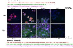 Invitrogen™ Goat anti-Human IgG (H+L) Cross-Adsorbed Secondary Antibody, Alexa Fluor™ Plus 555