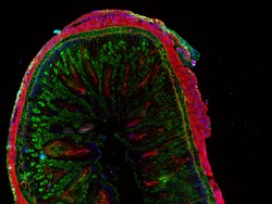 Invitrogen F(ab')2-Goat anti-Rabbit IgG (H+L) Cross-Adsorbed Secondary