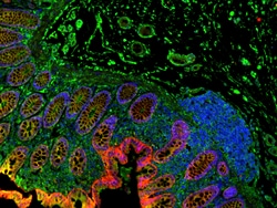 Invitrogen F(ab')2-Goat anti-Rabbit IgG (H+L) Cross-Adsorbed Secondary