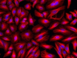 Invitrogen F(ab')2-Goat anti-Rabbit IgG (H+L) Cross-Adsorbed Secondary Antibody, Alexa Fluor Plus 594 500 &mu;g | Buy Online | Invitrogen&trade; | Fisher Scientific