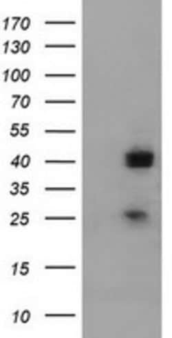 A4GNT Mouse anti-Human, Clone: OTI2H9, lyophilized, TrueMAB 100 &mu;g;