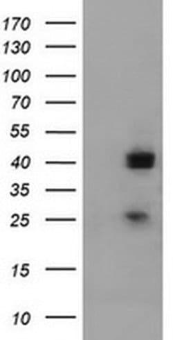 A4GNT Mouse anti-Human, Clone: OTI2H9, liquid, TrueMAB 100 &mu;L; Unconjugated:Antibodies,