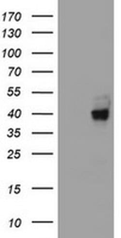 A4GNT Monoclonal Antibody (OTI1F7), TrueMAB , OriGene:Antibodies:Primary