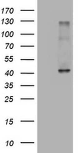A4GNT Monoclonal Antibody (OTI2C1), TrueMAB , OriGene 30 &mu;L; Unconjugated:Antibodies,