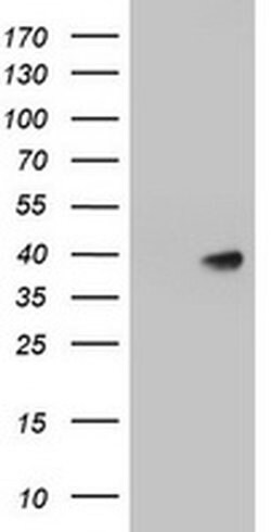 A4GNT Monoclonal Antibody (OTI1B10), TrueMAB , OriGene 100 &mu;L; Unconjugated:Antibodies,