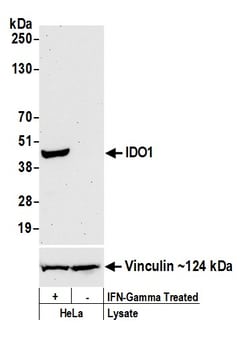 Bethyl Laboratories IDO1 Recombinant Rabbit Monoclonal Antibody (BLR040F)