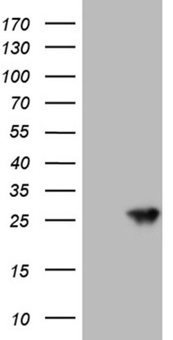 AANAT Monoclonal Antibody (OTI6E1), TrueMAB , OriGene 100 &mu;L; Unconjugated:Antibodies,