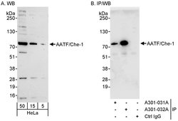AATF/Che-1 Rabbit anti-Human, Polyclonal, Bethyl Laboratories 100 &mu;l;