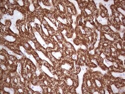 ABAT Monoclonal Antibody (OTI3D2), TrueMAB , OriGene 100 &mu;L; Unconjugated:Antibodies,