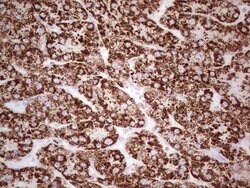 ABAT Monoclonal Antibody (OTI3D2), TrueMAB , OriGene 100 &mu;L; Unconjugated:Antibodies,