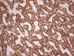 ABAT Monoclonal Antibody (OTI6H1), TrueMAB , OriGene 100 &mu;L; Unconjugated:Antibodies,