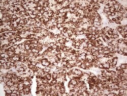 ABAT Monoclonal Antibody (OTI6H1), TrueMAB , OriGene:Antibodies:Primary