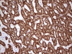 ABAT Monoclonal Antibody (OTI1F10), TrueMAB , OriGene 100 &mu;L; Unconjugated:Antibodies,