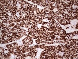 ABAT Monoclonal Antibody (OTI1F10), TrueMAB , OriGene 100 &mu;L; Unconjugated:Antibodies,