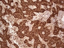 ABAT Mouse anti-Human, Clone: OTI6C9, lyophilized, TrueMAB 100 &mu;g; Unconjugated:Antibodies,