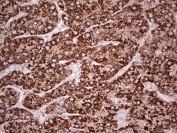 ABAT Mouse anti-Human, Clone: OTI6C9, lyophilized, TrueMAB 100 &mu;g; Unconjugated:Antibodies,