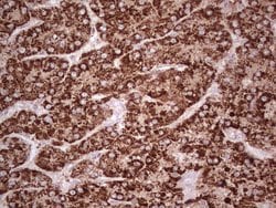 ABAT Monoclonal Antibody (OTI6C9), TrueMAB , OriGene:Antibodies:Primary