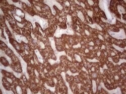 ABAT Mouse anti-Human, Clone: OTI7H1, lyophilized, TrueMAB 100 &mu;g; Unconjugated:Antibodies,