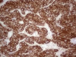 ABAT Mouse anti-Human, Clone: OTI7H1, lyophilized, TrueMAB 100 &mu;g; Unconjugated:Antibodies,