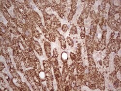 ABAT Mouse anti-Human, Clone: OTI4A10, lyophilized, TrueMAB 100 &mu;g;