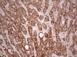 ABAT Monoclonal Antibody (OTI4A10), TrueMAB , OriGene 100 &mu;L; Unconjugated:Antibodies,