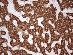ABAT Monoclonal Antibody (OTI7E9), TrueMAB , OriGene 30 &mu;L; Unconjugated:Antibodies,