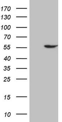 ABAT Monoclonal Antibody (OTI3D2), TrueMAB , OriGene 100 &mu;L; Unconjugated:Antibodies,