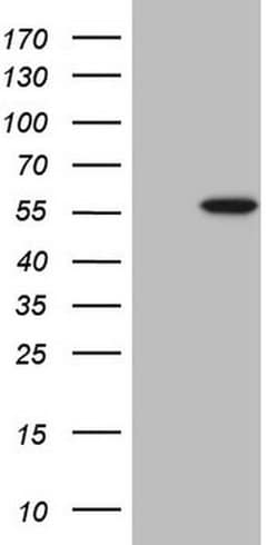 ABAT Monoclonal Antibody (OTI6H1), TrueMAB , OriGene 100 &mu;L; Unconjugated:Antibodies,