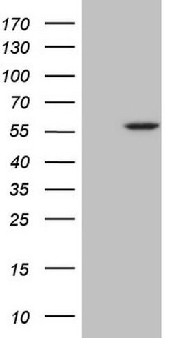 ABAT Monoclonal Antibody (OTI1F10), TrueMAB , OriGene 100 &mu;L; Unconjugated:Antibodies,