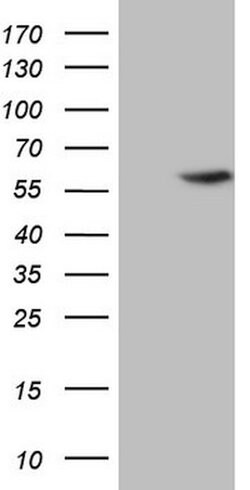 ABAT Mouse anti-Human, Clone: OTI7H1, lyophilized, TrueMAB 100 &mu;g; Unconjugated:Antibodies,