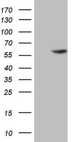 ABAT Mouse anti-Human, Clone: OTI7H1, TrueMAB , Origene 30 &mu;L; Unconjugated:Antibodies,