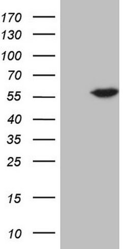 ABAT Mouse anti-Human, Clone: OTI4A10, lyophilized, TrueMAB 100 &mu;g;