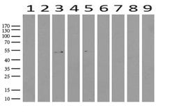 ABAT Mouse anti-Human, Clone: UMAB178, liquid, UltraMAB 100 &mu;L | Buy Online | OriGene | Fisher Scientific