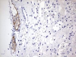 ABCB1 Monoclonal Antibody (OTI3C8), TrueMAB , OriGene:Antibodies:Primary