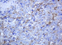 ABCB1 Monoclonal Antibody (OTI6H2), TrueMAB , OriGene 100 &mu;L; Unconjugated:Antibodies,