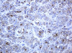 ABCB1 Monoclonal Antibody (OTI6H2), TrueMAB , OriGene 100 &mu;L; Unconjugated:Antibodies,