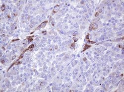 ABCB1 Monoclonal Antibody (OTI2G6), TrueMAB , OriGene 30 &mu;L; Unconjugated:Antibodies,