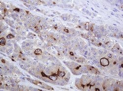 ABCB1 Monoclonal Antibody (OTI3B2), TrueMAB , OriGene 100 &mu;L; Unconjugated:Antibodies,