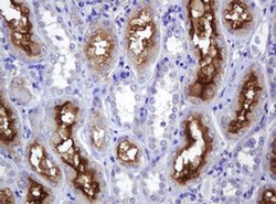 ABCB1 Monoclonal Antibody (OTI3B2), TrueMAB , OriGene 100 &mu;L; Unconjugated:Antibodies,