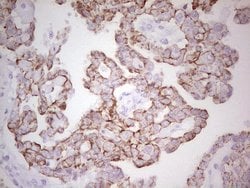 ABCB1 Monoclonal Antibody (OTI8A9), TrueMAB , OriGene 100 &mu;L; Unconjugated:Antibodies,