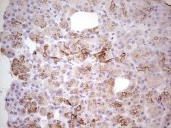ABCB1 Monoclonal Antibody (OTI8A9), TrueMAB , OriGene 100 &mu;L; Unconjugated:Antibodies,