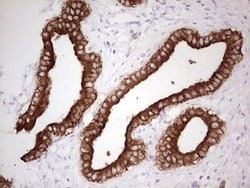 ABCB1 Monoclonal Antibody (OTI8A9), TrueMAB , OriGene 100 &mu;L; Unconjugated:Antibodies,