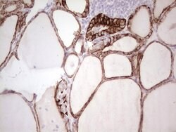 ABCB1 Monoclonal Antibody (OTI8A9), TrueMAB , OriGene 100 &mu;L; Unconjugated:Antibodies,