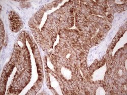 ABCB1 Monoclonal Antibody (OTI8A9), TrueMAB , OriGene 100 &mu;L; Unconjugated:Antibodies,