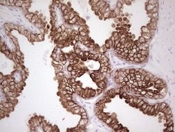 ABCB1 Monoclonal Antibody (OTI8A9), TrueMAB , OriGene 100 &mu;L; Unconjugated:Antibodies,