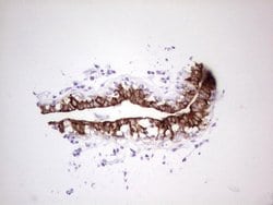 ABCB1 Monoclonal Antibody (OTI8A9), TrueMAB , OriGene 100 &mu;L; Unconjugated:Antibodies,