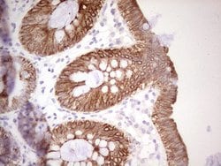 ABCB1 Monoclonal Antibody (OTI8A9), TrueMAB , OriGene 100 &mu;L; Unconjugated:Antibodies,