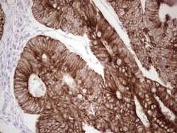 ABCB1 Monoclonal Antibody (OTI8A9), TrueMAB , OriGene 100 &mu;L; Unconjugated:Antibodies,