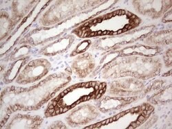 ABCB1 Monoclonal Antibody (OTI8A9), TrueMAB , OriGene 100 &mu;L; Unconjugated:Antibodies,
